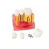 Model - implant, korony oraz most protetyczny CSK-027
