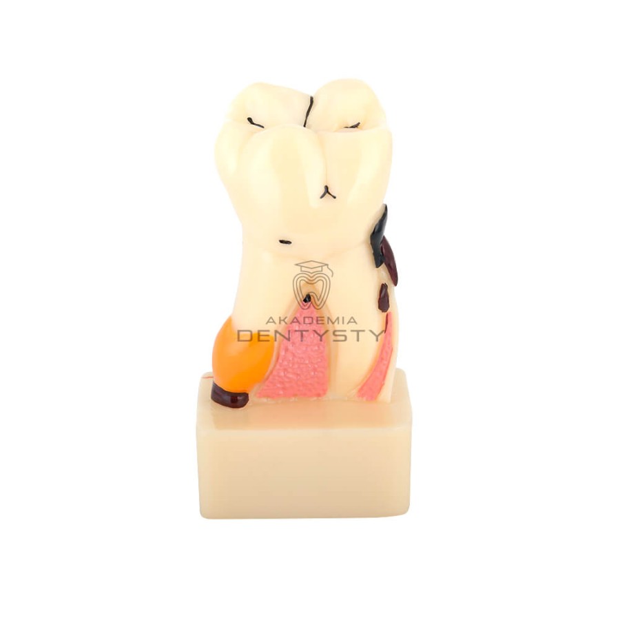 Model zęba człowieka PERIO-01