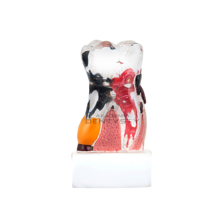 Model zęba człowieka PERIO-02