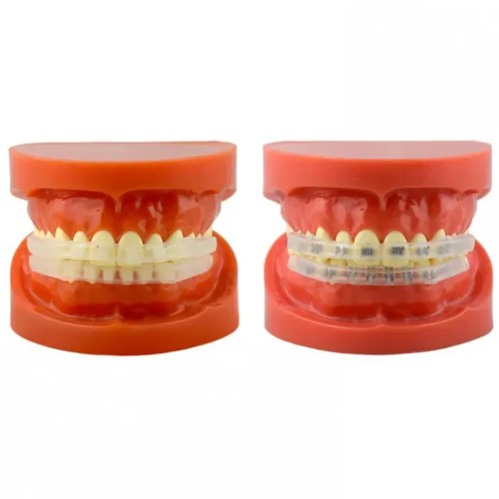 Ochraniacze wargowe silikonowe, para