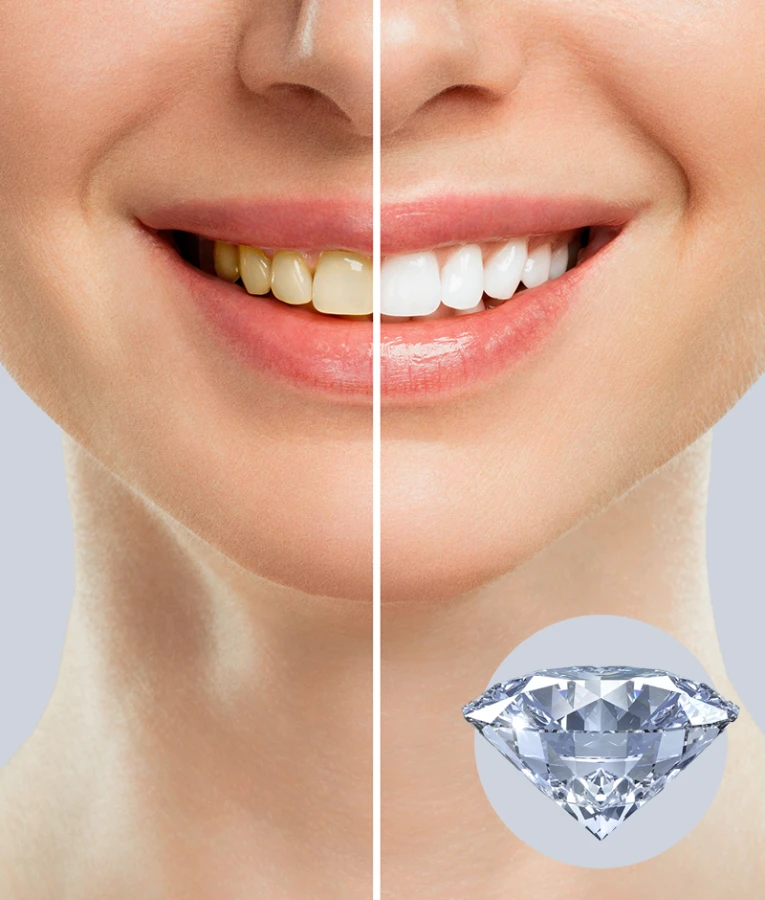 Wild Emoform Diamond