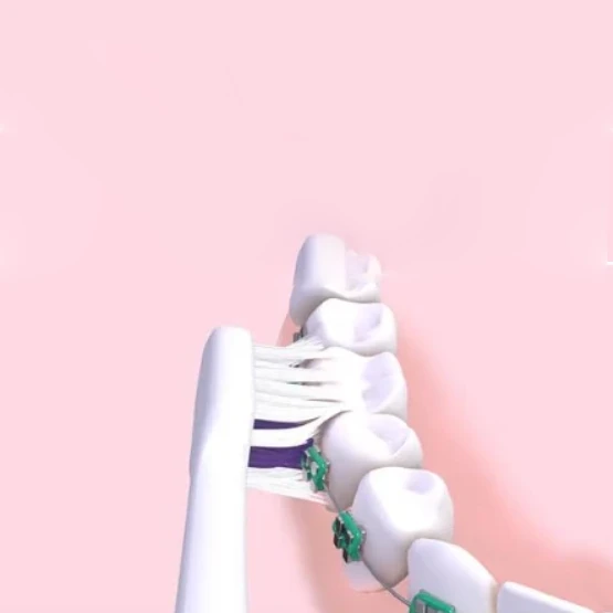 Gum Sonic Ortho – szczoteczka soniczna do zębów