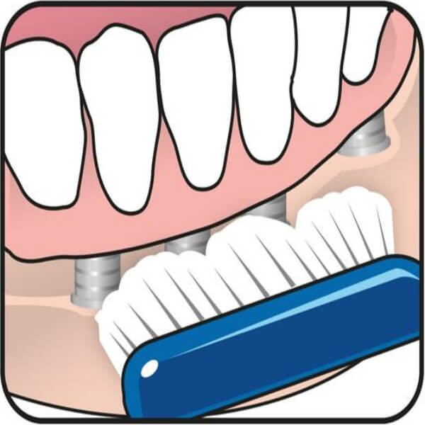 TEPE IMPLANT/ORTHO - szczoteczka ortodontyczna BLISTER