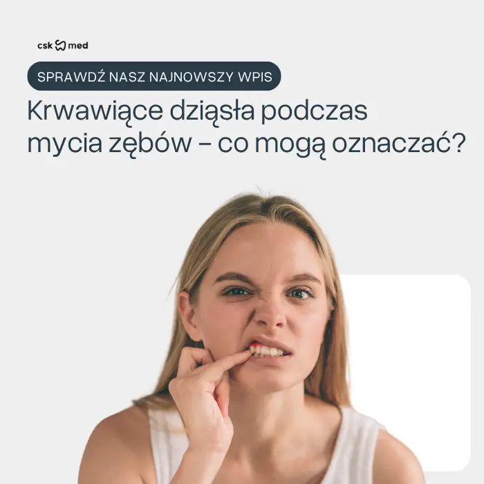 Krwawiące dziąsła podczas mycia zębów? Co mogą oznaczać?